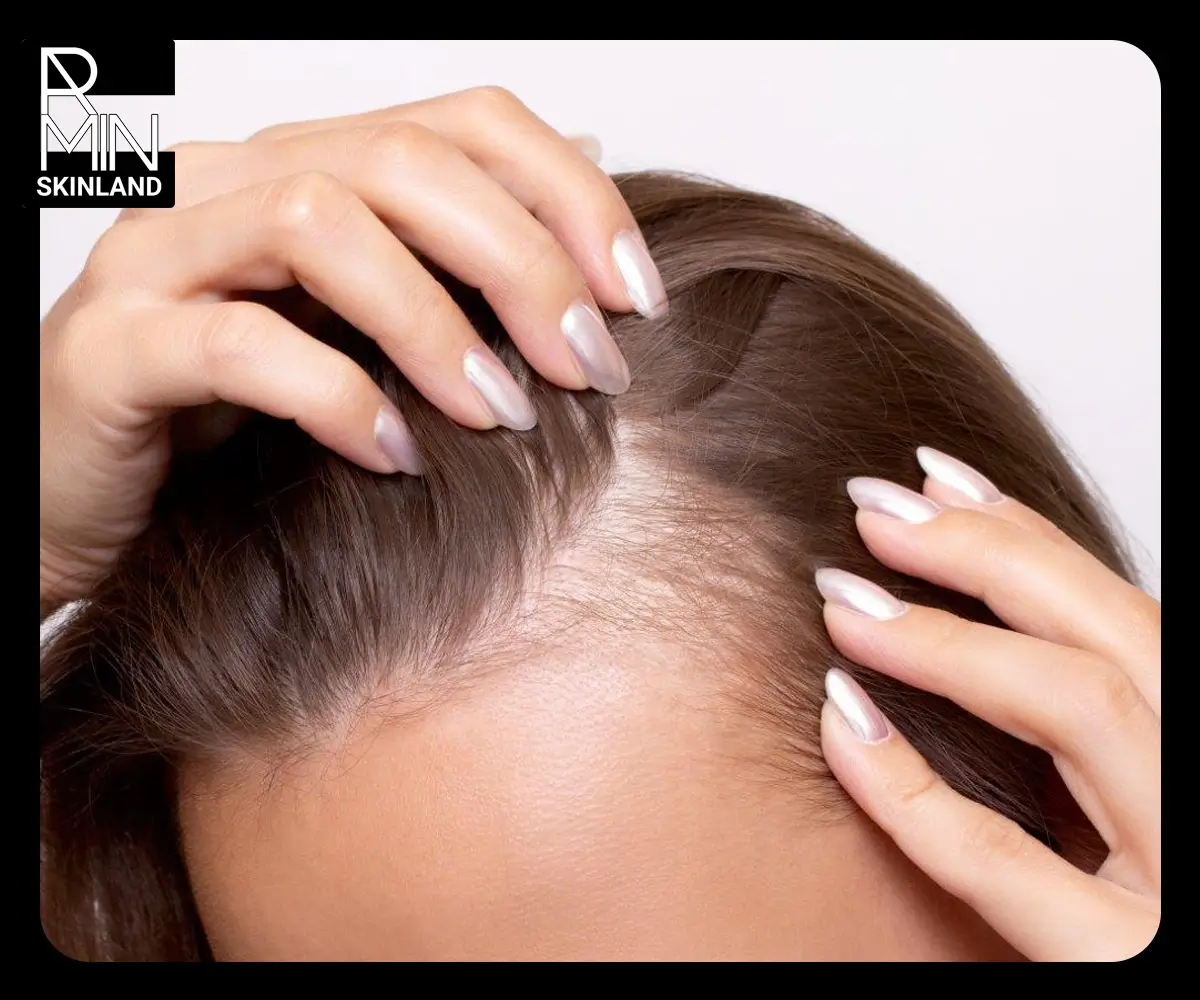 معرفی بهترین شامپو برای ریزش مو خانم ها